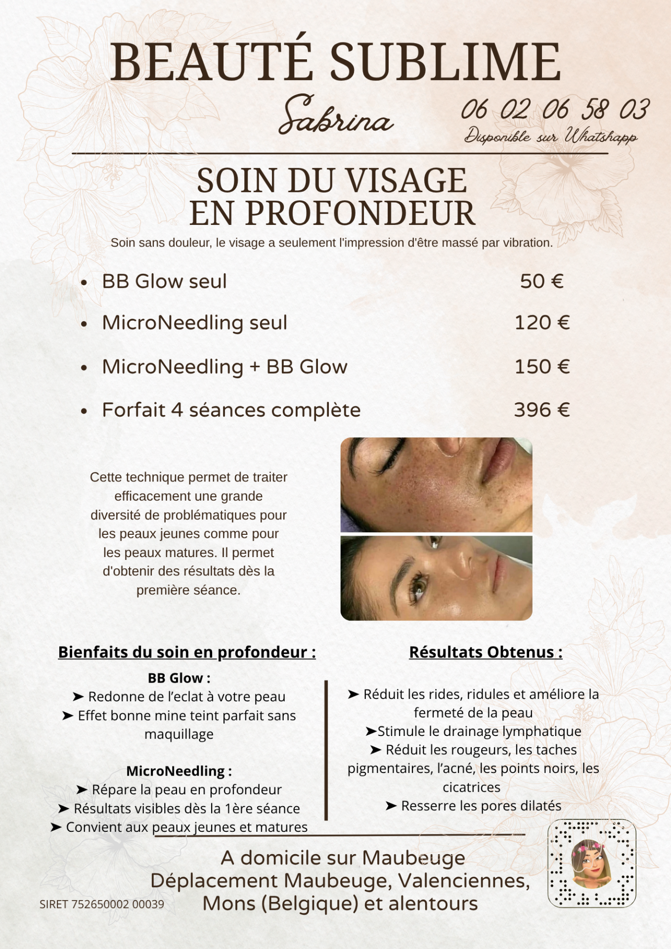 Microneeding et BB glow